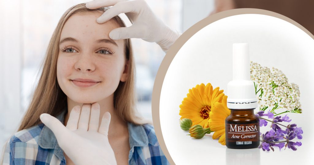 Лосион за акне с натурални био съставки от Екомаат