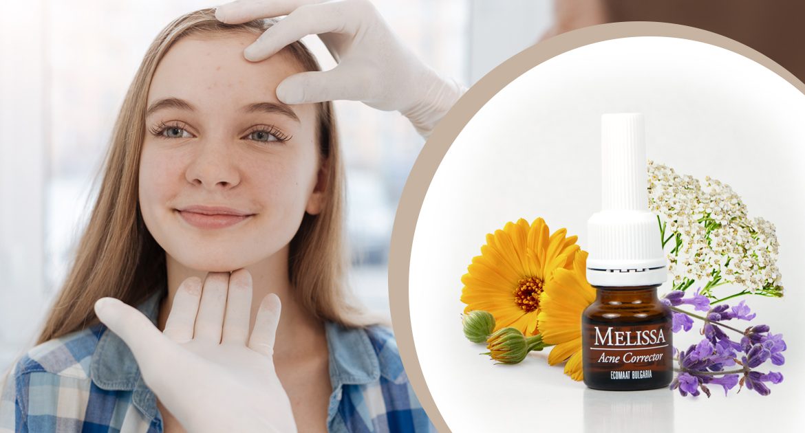 Лосион за акне с натурални био съставки от Екомаат